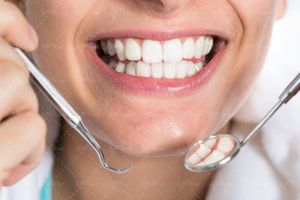 دندان سفید ابزار آلات دندان پزشکی