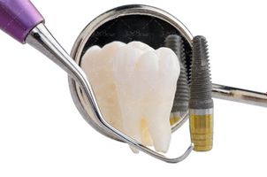 دندان پزشکی دندان لوازم دندان پزشکی 11