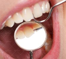 دندان پزشکی دندان لوازم دندان پزشکی 4