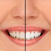 دندان پزشکی دندان لوازم دندان پزشکی 8