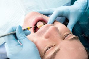 دندان پزشکی تجهیزات دندان پزشکی بهداشت دندان 15