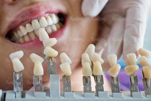 دندان پزشکی گذاشتن دندان,دندان مصنوعی