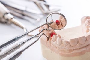 تجهیزات دندان پزشکی مولاژ آمپول بی حسی کاشت دندان5
