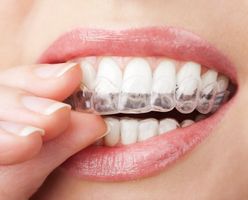 دندانپزشکی روکش دندان بهداشت دهان 1