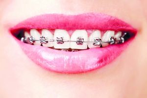 دندانپزشکی آرتودونسی دندان دهان