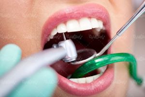 دندان پزشکی ترمیم دندان