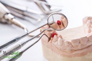 مولاژ دندان پزشکی