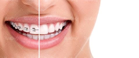 Dental