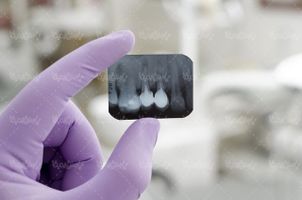 Dental
