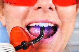Dental