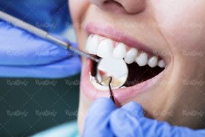 Dental