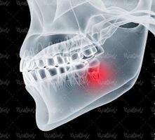 تصویر دندان با اشعه ایکس