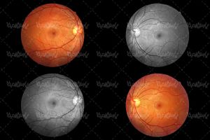 retina