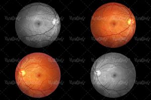 retina