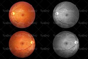 retina