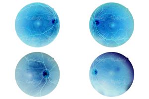 retina