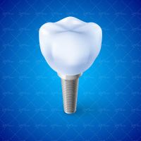 وکتور دندان دندان پزشکی دندان سفید ایمپلنت کاشتن دندان