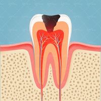 وکتور دندان خراب وکتور دندان پزشکی 1