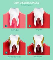 وکتور جرم دندان وکتور دندان پزشکی