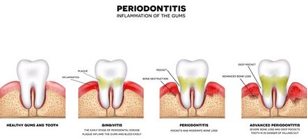 Dental Vector