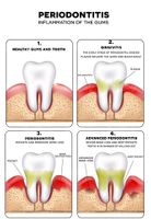 Dental Vector