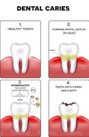 Dental Vector