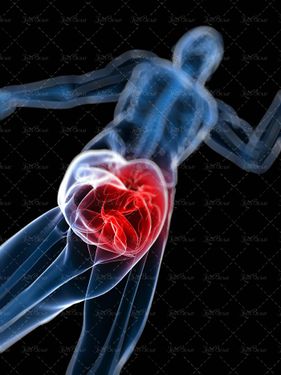 درد زانو  فیزیوتراپی  ارتوپد درد