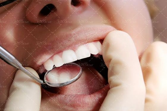 دندان پزشکی دندان لوازم دندان پزشکی