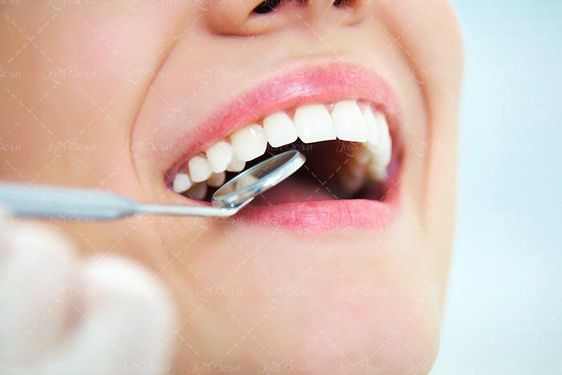 دندان پزشکی دندان لوازم دندان پزشکی 3