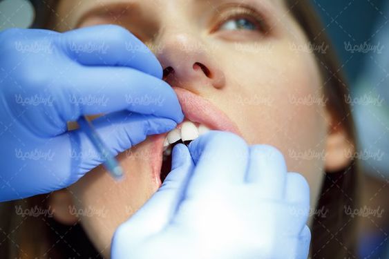 دندان پزشکی دندان پزشک بهداشت دندان