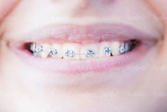 دندان پزشکی ارتودنسی