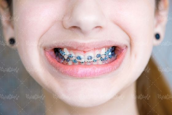دندان پزشکی ارتودنسی