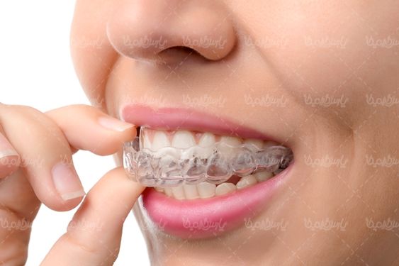 داندان پزشکی ارتودنسی دندان های منظم