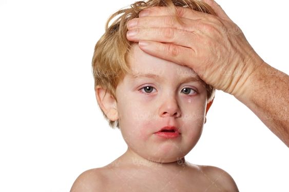 کودک بیمار سرماخوردگی آبریزش بینی