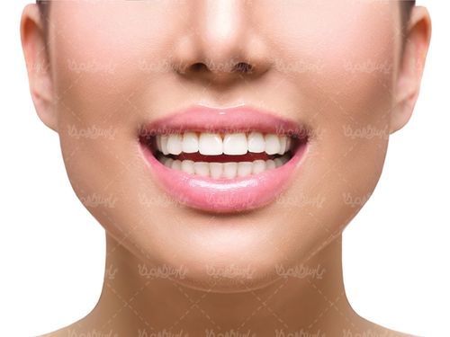 دندان پزشکی دندان های سفید