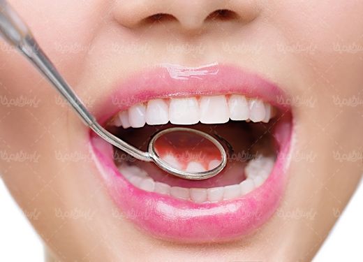 دندان پزشکی دندان های سفید