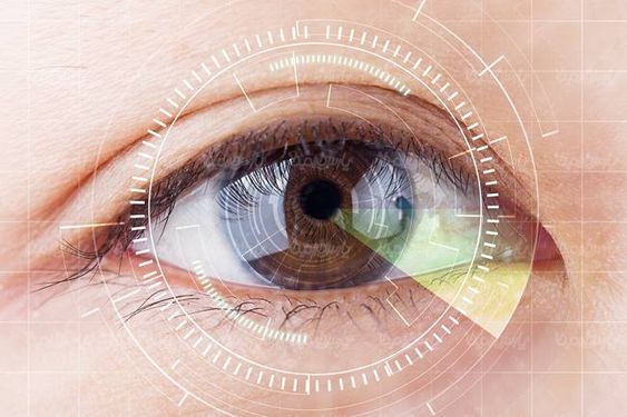 سالن آرایش آریش چشم لنز رنگی آرایشی سالن زیبایی3