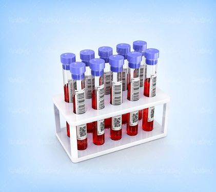 شیشه آزمایش آزمایشگاه دارو سازی شیشه پایلوت28