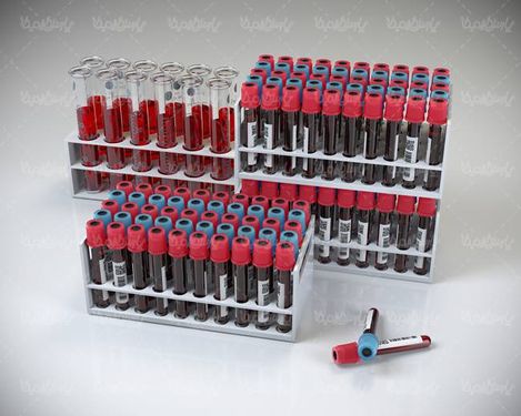 شیشه آزمایش آزمایشگاه دارو سازی شیشه آزمایش خون1