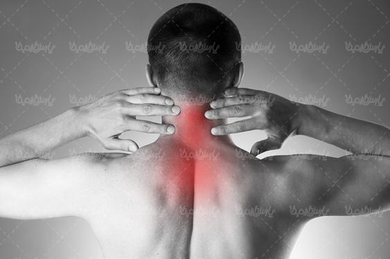 درد گردن  درد موضعی فیزیوتراپی