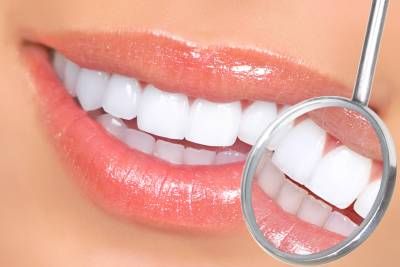 دندان دندانپزشکی آینه لثه دهان 2