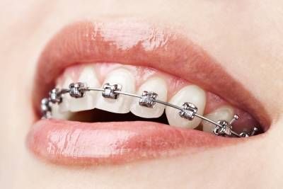 ارتودنسی دندان سلامت و بهداشت