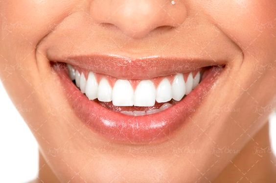 دندان پزشکی ارتودنسی دندان1 