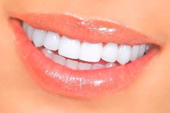 دندان پزشکی ارتودنسی دندان3 