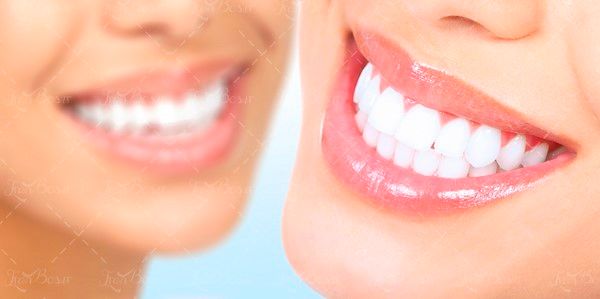 جرم گیری دندان ،دندان پزشک3 