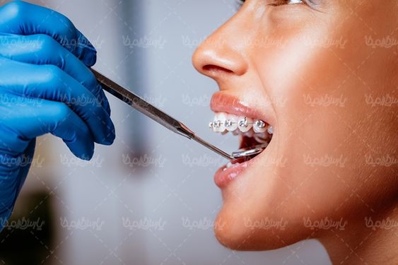 دندان پزشکی تجهیزات دندان پزشکی