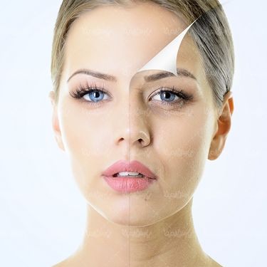 کلینیک زیبایی رفع جوش های صورت