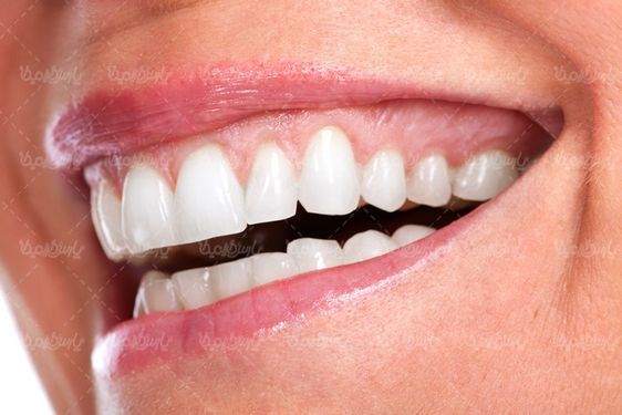 White teeth