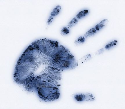 Hand