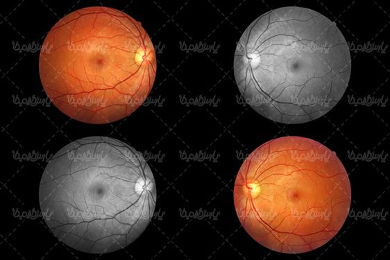retina